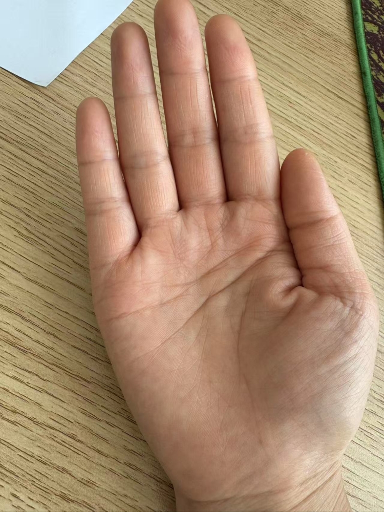 ��